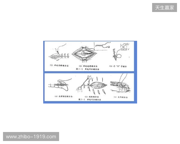 广州豹官方：杨浩眉弓伤口缝合30余针，预计5-7天后拆线